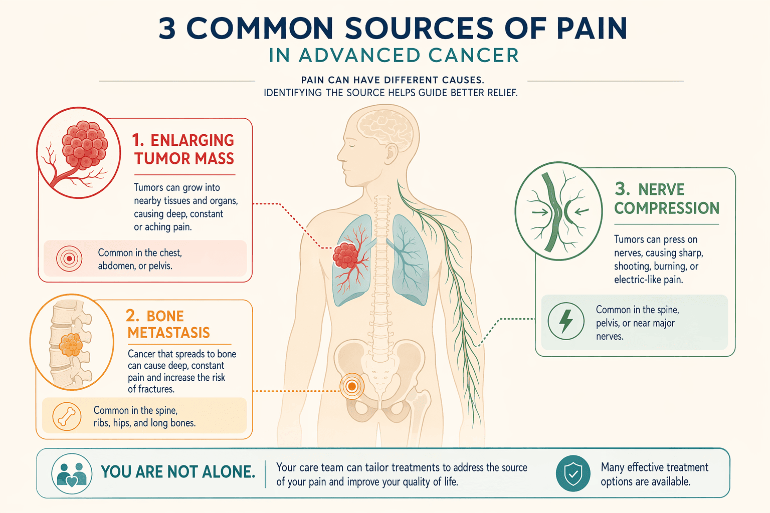 Illustration for: Disease Progression and New Pain Sources