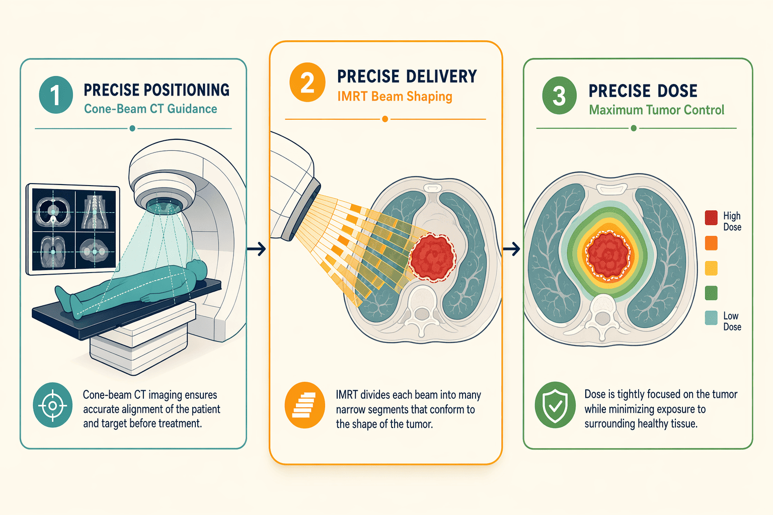 Illustration for: How Modern Precision Radiotherapy (IGRT/IMRT) Reduces Side Effect Severity