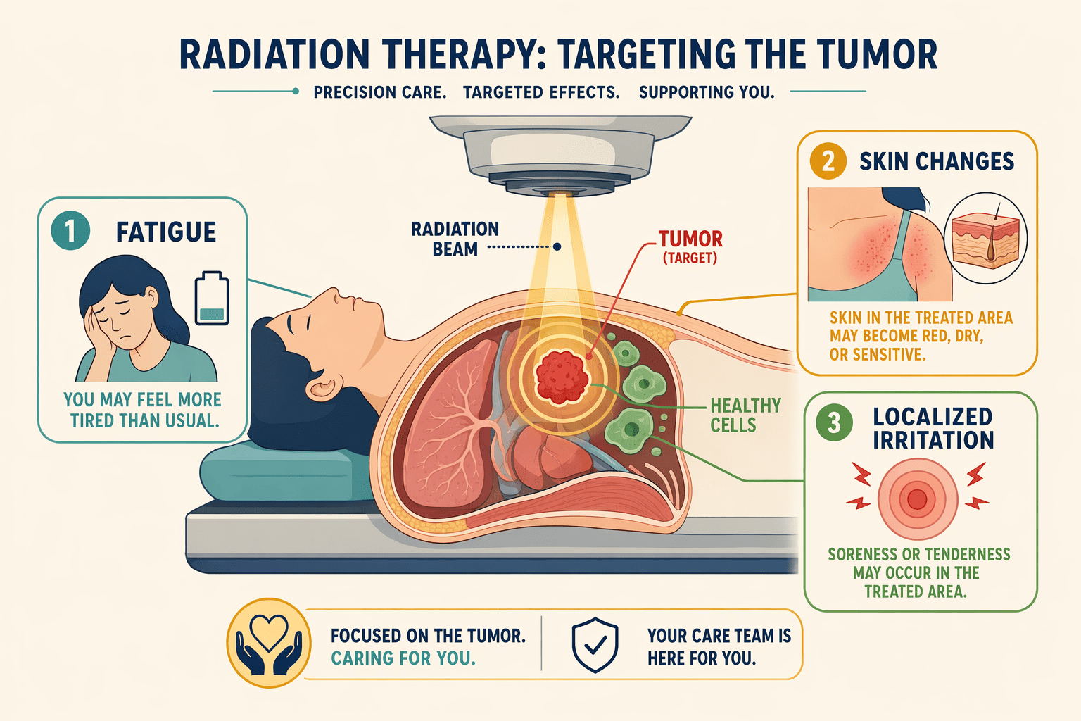 Illustration for: Understanding Radiation Therapy Side Effects: What Every Patient Should Know