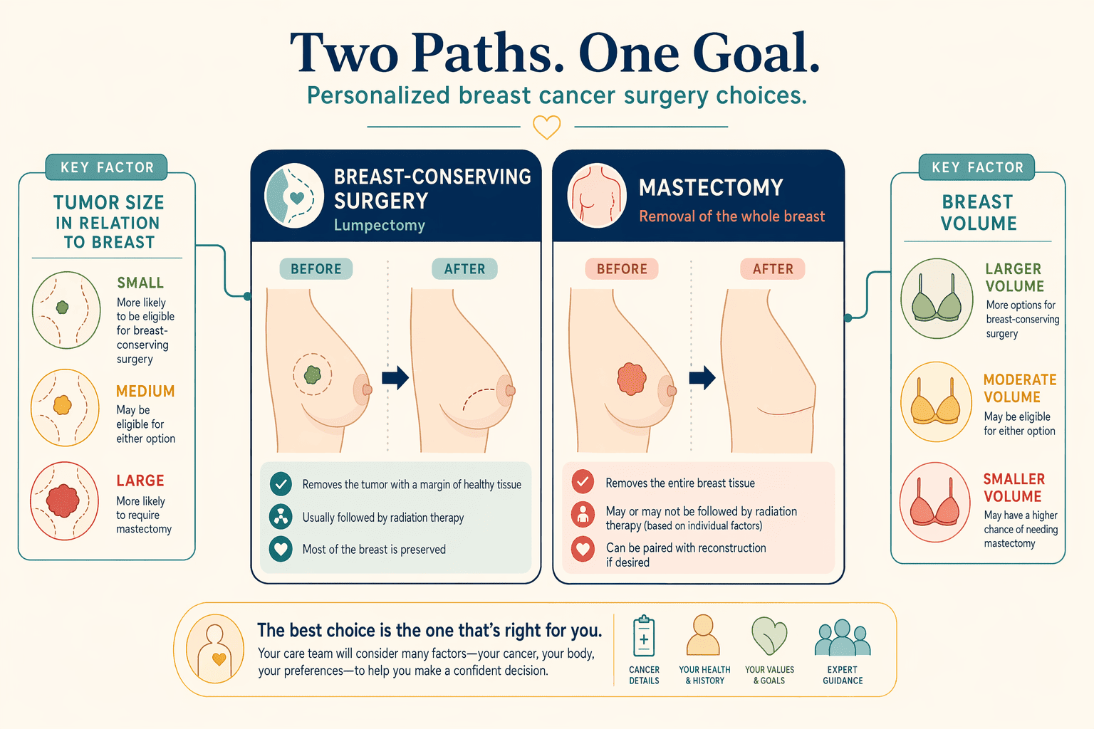 Illustration for: Breast Conservation Vs. Mastectomy: Why Options Matter
