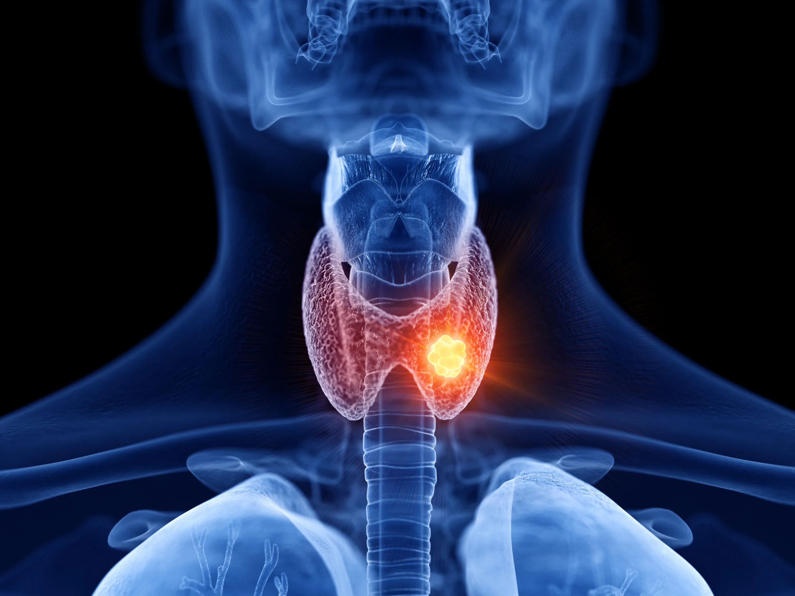 Thyroid & Endocrine Cancers