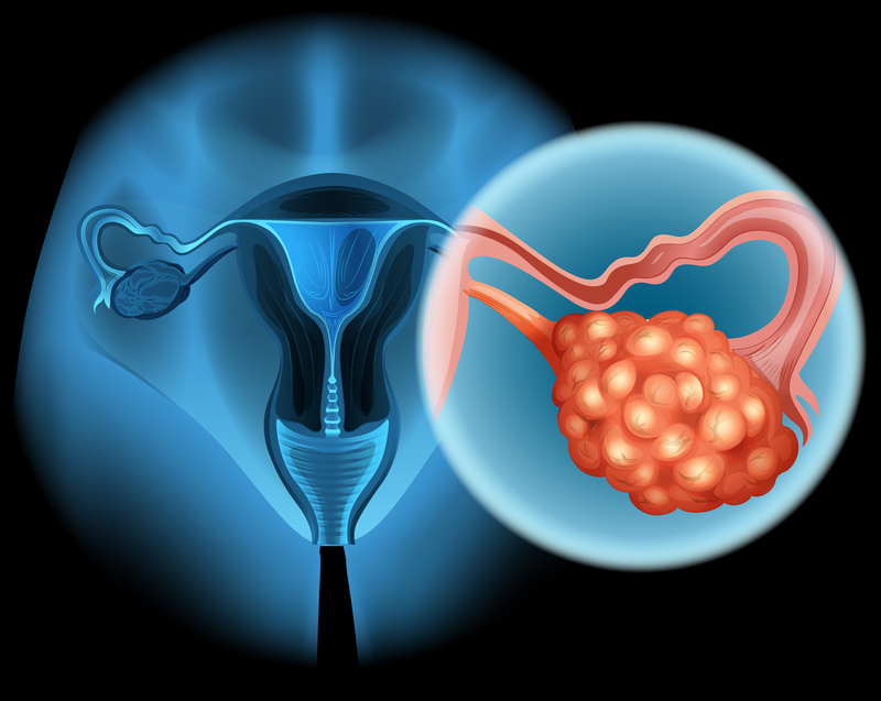 Gynaecological Cancers